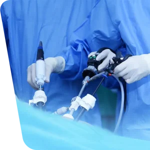 Imaginea oferă un close-up detaliat cu echipamentul medical laparoscopic utilizat în timpul unei intervenții chirurgicale. Aflați mai multe despre beneficiile și tehnologiile implicate în laparoscopie în articolul nostru specializat.